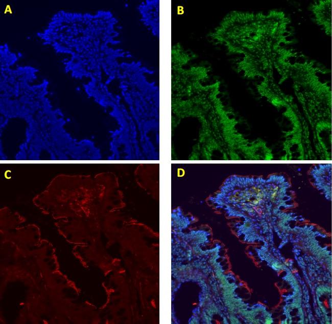 Goat IgG (H+L) Cross-Adsorbed Secondary Antibody in Immunocytochemistry (ICC/IF)