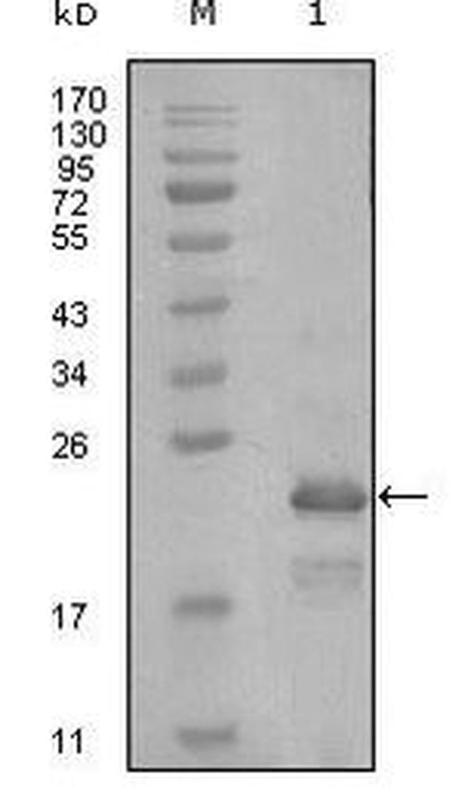 HAND1 Antibody in Western Blot (WB)