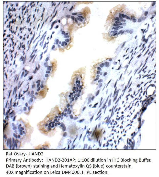 HAND2 Antibody in Immunohistochemistry (IHC)