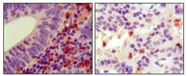 HCK Antibody in Immunohistochemistry (Paraffin) (IHC (P))