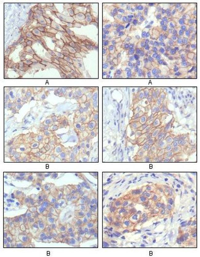 ErbB2 (HER-2) Antibody in Immunohistochemistry (Paraffin) (IHC (P))