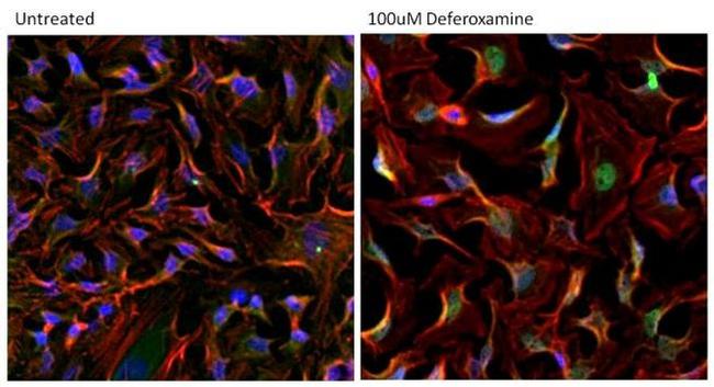 HIF1A Antibody in Immunocytochemistry (ICC/IF)