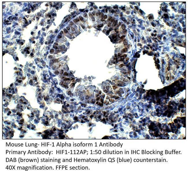 HIF-1-Alpha isoform 1 + 2 Antibody in Immunohistochemistry (IHC)