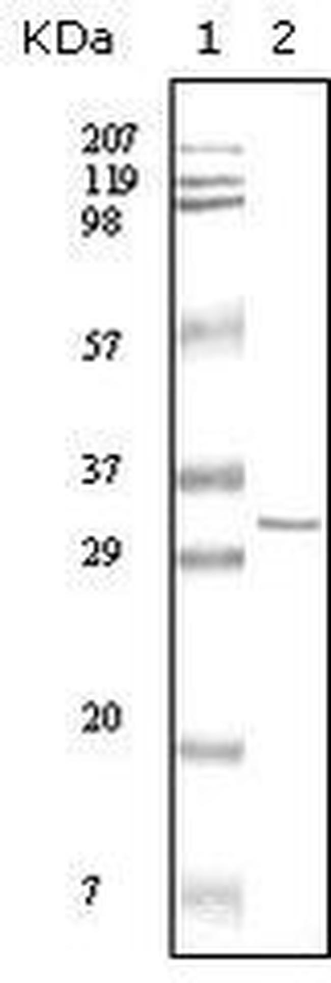 HPRT1 Antibody in Western Blot (WB)