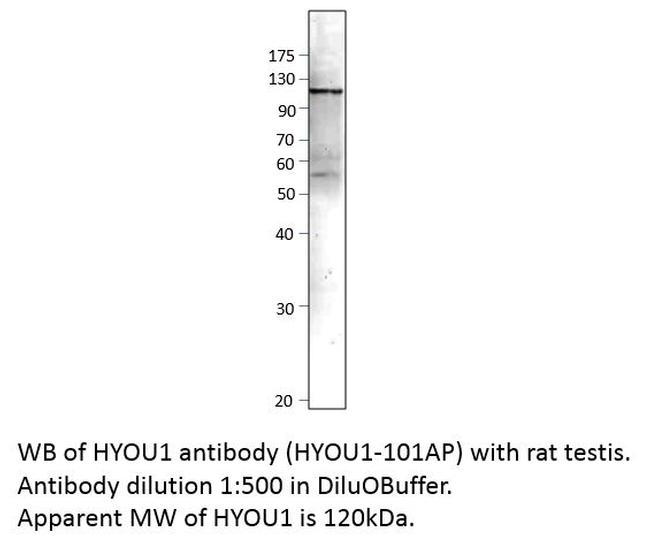 ORP150 Antibody in Western Blot (WB)