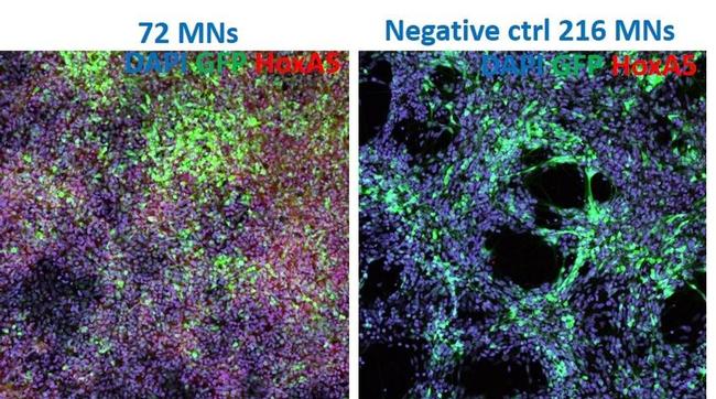 HOXA5 Antibody in Immunocytochemistry (ICC/IF)