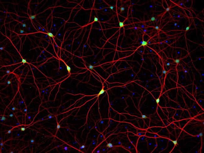 HuC/HuD Antibody in Immunocytochemistry (ICC/IF)