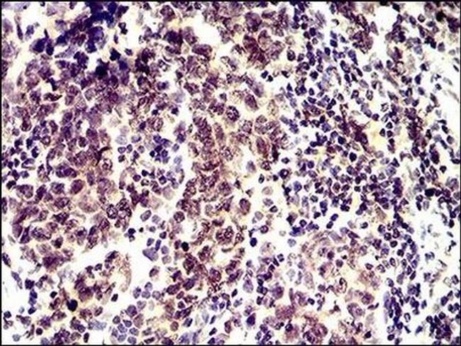 ID2 Antibody in Immunohistochemistry (Paraffin) (IHC (P))