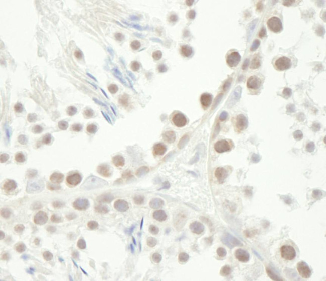 Chk1 Antibody in Immunohistochemistry (Paraffin) (IHC (P))