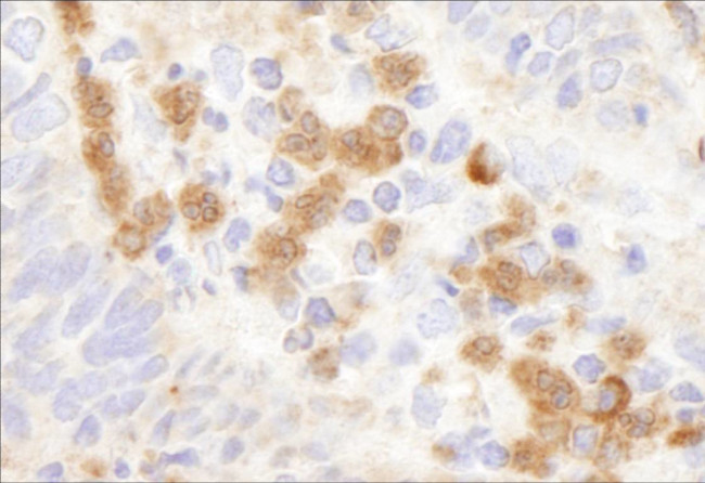 G6PD Antibody in Immunohistochemistry (Paraffin) (IHC (P))