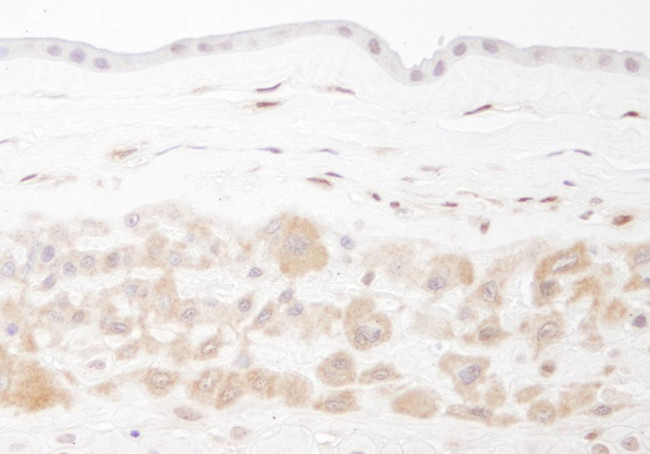 PBEF Antibody in Immunohistochemistry (Paraffin) (IHC (P))