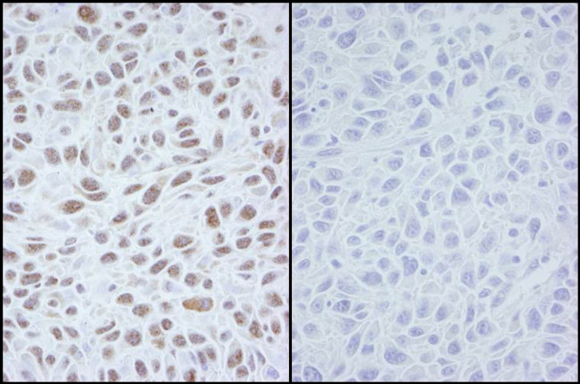 Phospho-SMC1 (Ser966) Antibody in Immunohistochemistry (Paraffin) (IHC (P))