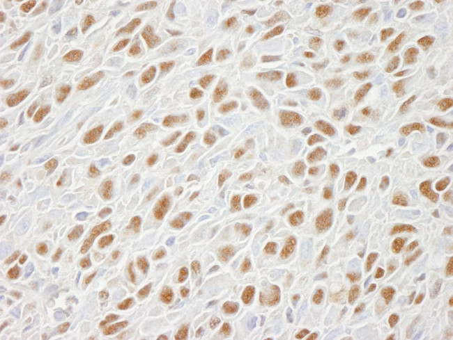 SMC1 Antibody in Immunohistochemistry (Paraffin) (IHC (P))