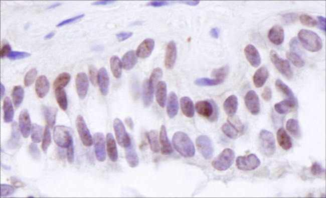 BRD8 Antibody in Immunohistochemistry (Paraffin) (IHC (P))