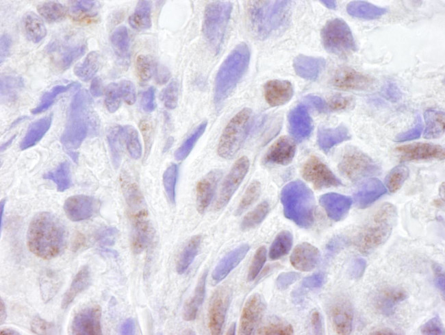 CBP Antibody in Immunohistochemistry (Paraffin) (IHC (P))