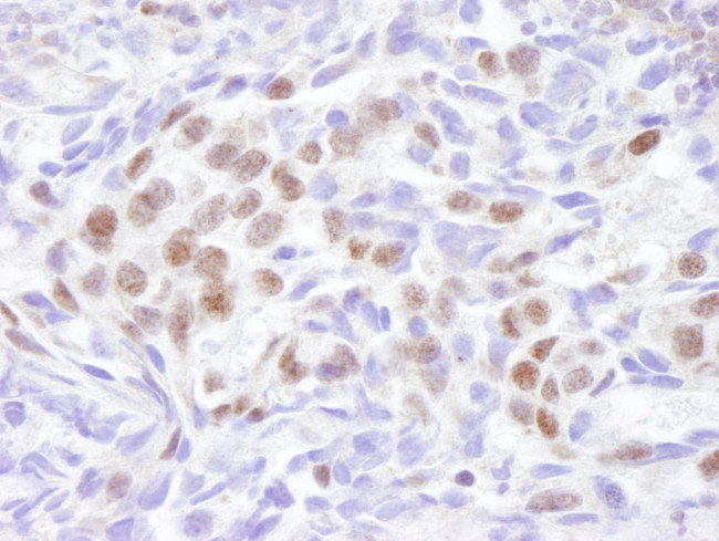 EDD1 Antibody in Immunohistochemistry (Paraffin) (IHC (P))