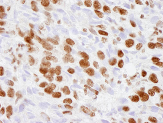 p300 Antibody in Immunohistochemistry (Paraffin) (IHC (P))