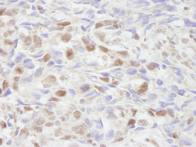 NCOA2/SRC2 Antibody in Immunohistochemistry (Paraffin) (IHC (P))