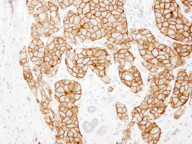 ErbB2 Antibody in Immunohistochemistry (Paraffin) (IHC (P))