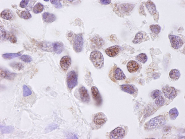 CKII alpha Antibody in Immunohistochemistry (Paraffin) (IHC (P))