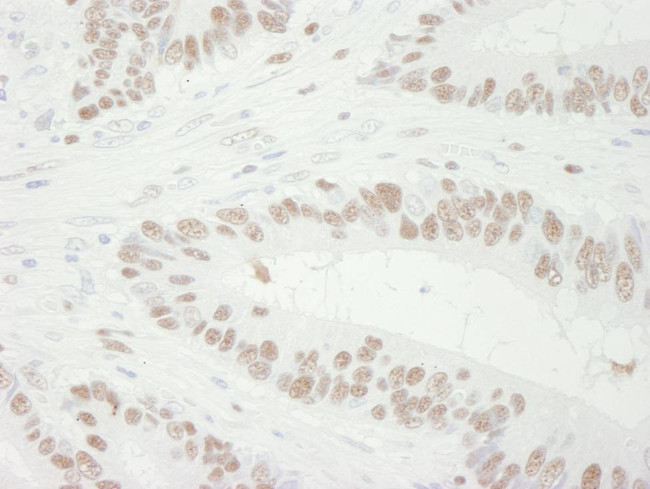 MCM3 Antibody in Immunohistochemistry (Paraffin) (IHC (P))