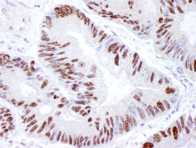 DNA-PKcs Antibody in Immunohistochemistry (Paraffin) (IHC (P))