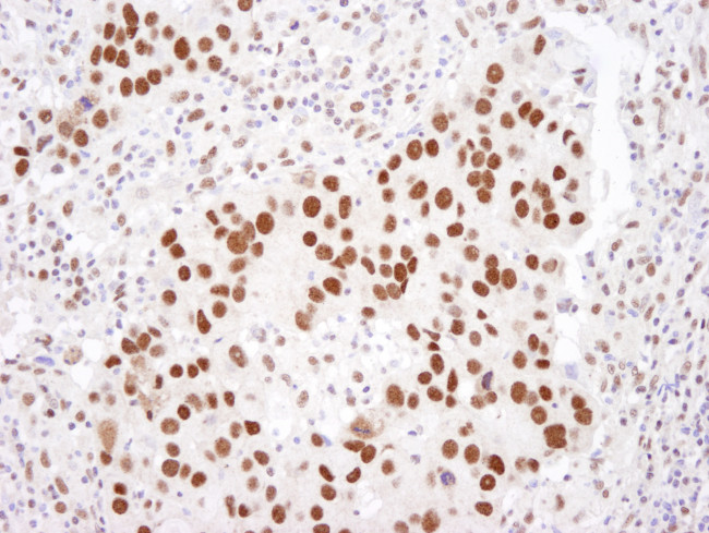 HDAC2 Antibody in Immunohistochemistry (Paraffin) (IHC (P))