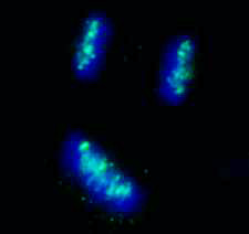 CENP-B Antibody in Immunocytochemistry (ICC/IF)