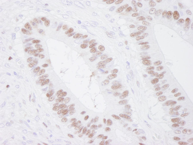 MCM3 Antibody in Immunohistochemistry (Paraffin) (IHC (P))