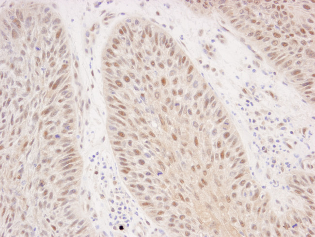 Rad50 Antibody in Immunohistochemistry (Paraffin) (IHC (P))