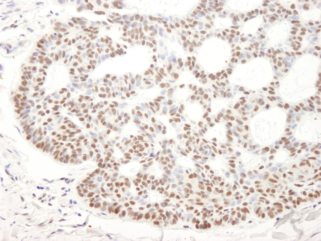 Bcl11b Antibody in Immunohistochemistry (Paraffin) (IHC (P))