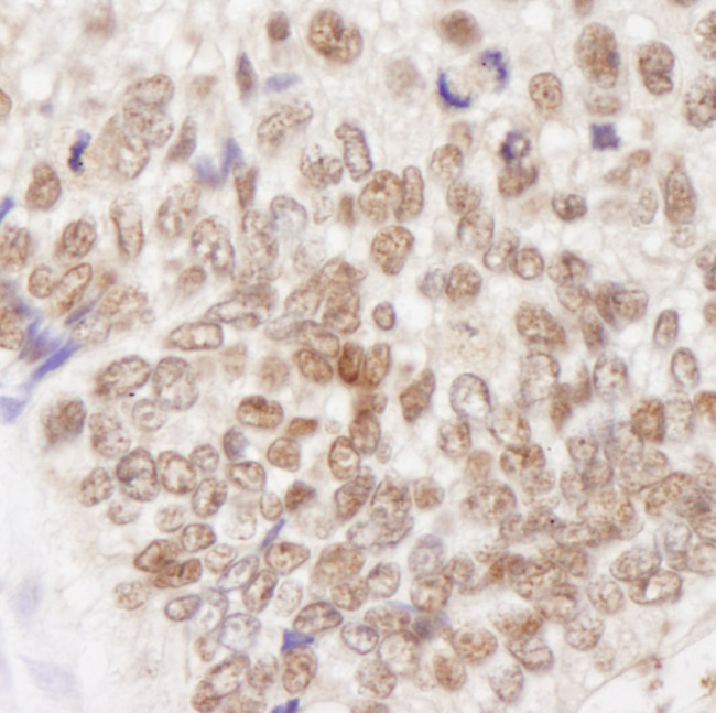 MSH2 Antibody in Immunohistochemistry (Paraffin) (IHC (P))