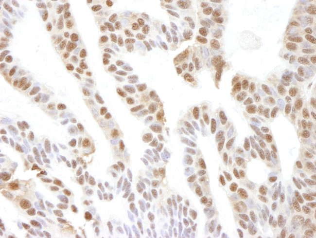 VCP Antibody in Immunohistochemistry (Paraffin) (IHC (P))