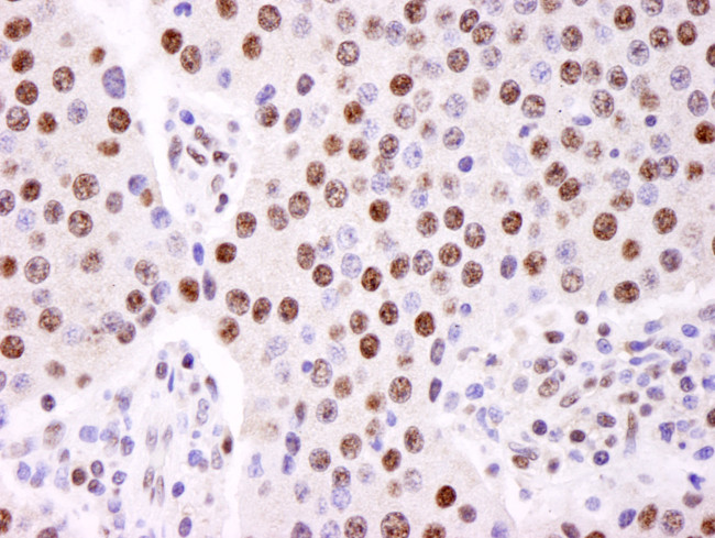 hnRNP-K Antibody in Immunohistochemistry (Paraffin) (IHC (P))