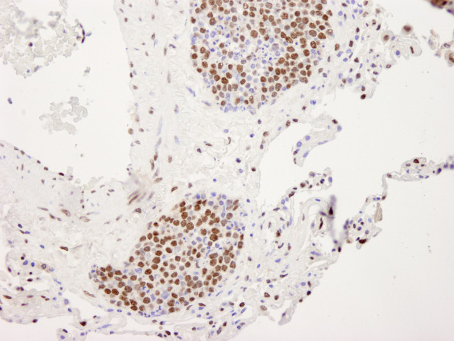 hnRNP-U Antibody in Immunohistochemistry (Paraffin) (IHC (P))