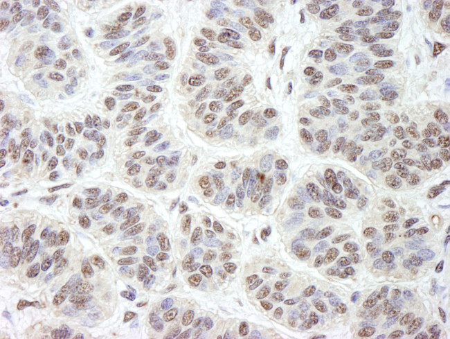 GNL3 Antibody in Immunohistochemistry (Paraffin) (IHC (P))