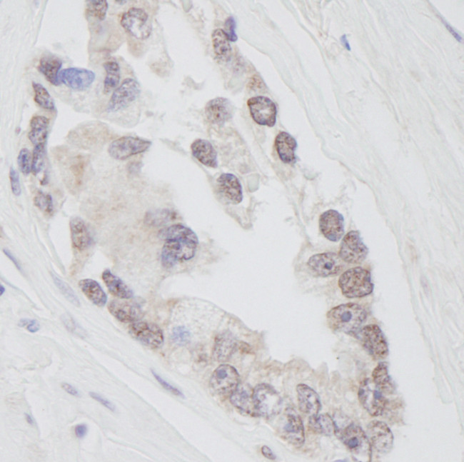 RNF40 Antibody in Immunohistochemistry (Paraffin) (IHC (P))