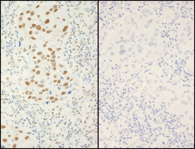 Phospho-XRCC1 (Ser518, Thr519, Thr523) Antibody in Immunohistochemistry (Paraffin) (IHC (P))