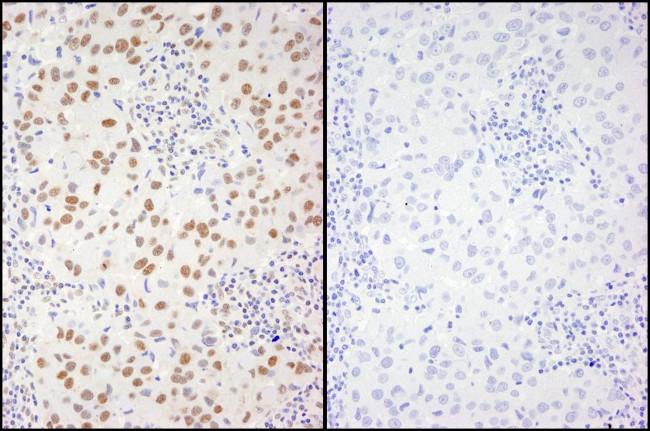 Phospho-XRCC1 (Ser461) Antibody in Immunohistochemistry (Paraffin) (IHC (P))