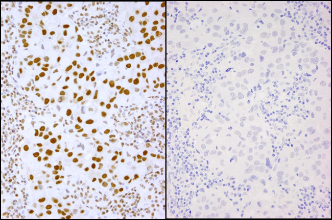 Phospho-XRCC1 (Ser485,Thr488) Antibody in Immunohistochemistry (Paraffin) (IHC (P))