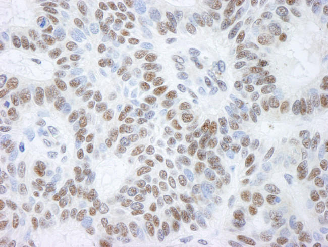 BHC110/LSD1 Antibody in Immunohistochemistry (Paraffin) (IHC (P))