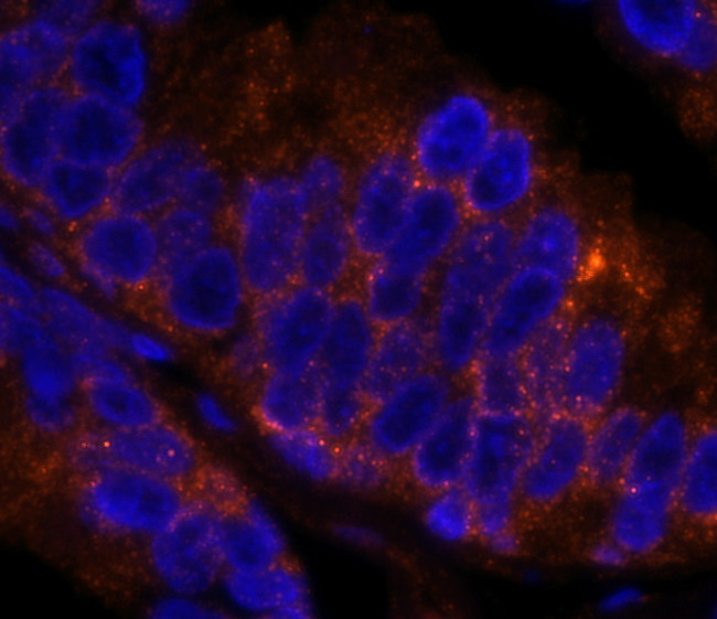 4E-T/eIF4E-T Antibody in Immunohistochemistry (Paraffin) (IHC (P))