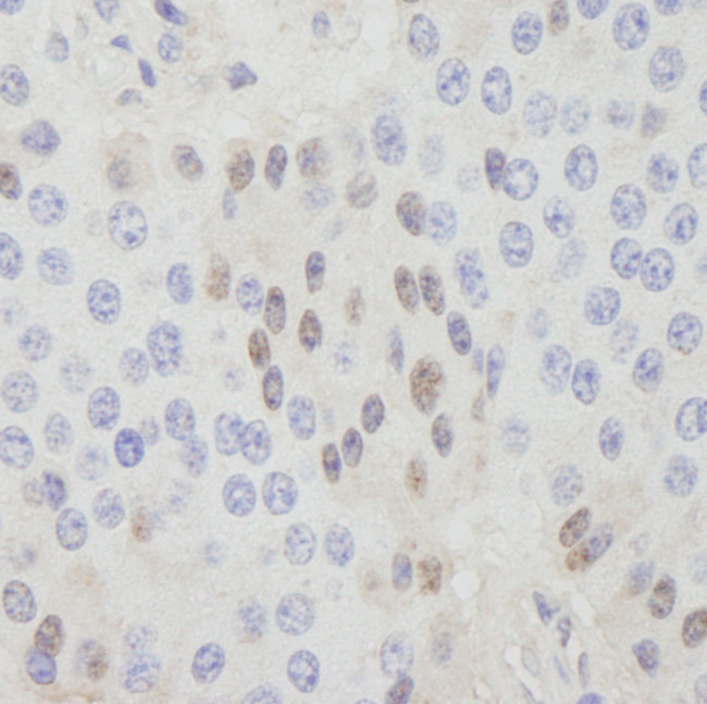 CDT1 Antibody in Immunohistochemistry (Paraffin) (IHC (P))