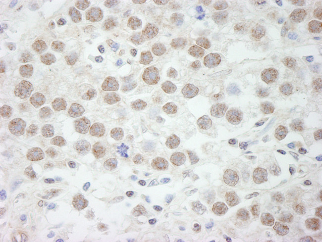 DDX17 Antibody in Immunohistochemistry (Paraffin) (IHC (P))