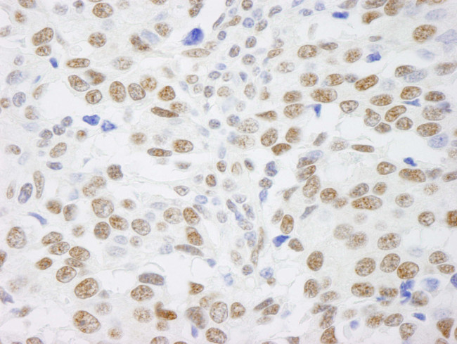 SAFB1 Antibody in Immunohistochemistry (Paraffin) (IHC (P))