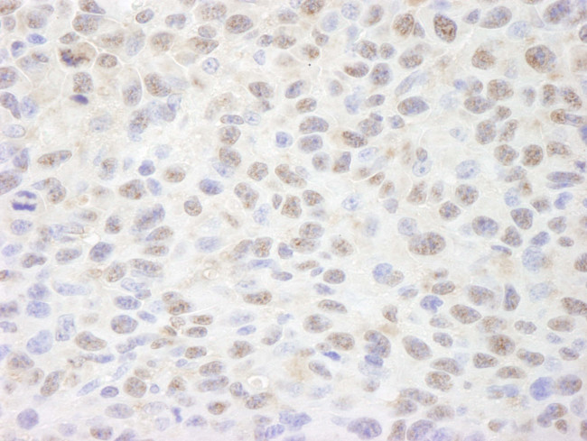 Sin3A Antibody in Immunohistochemistry (Paraffin) (IHC (P))