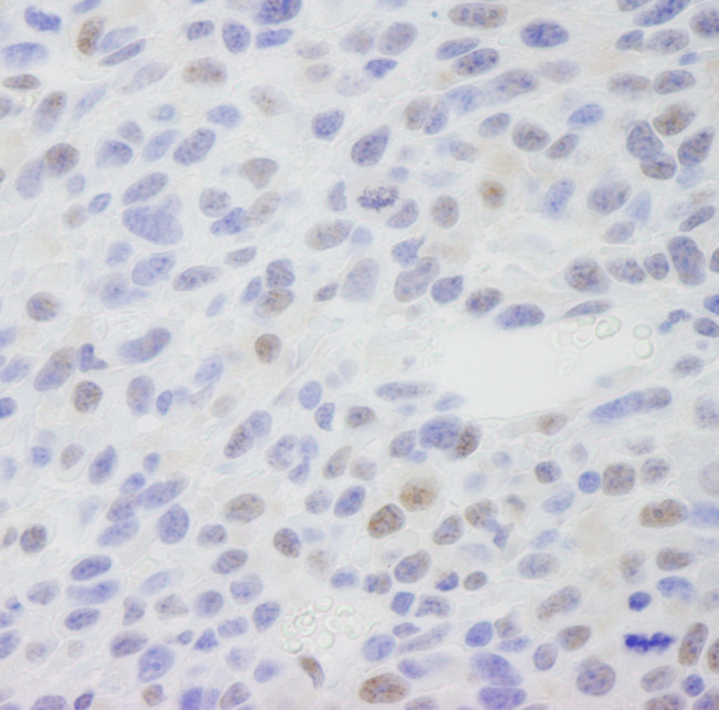 MED1 Antibody in Immunohistochemistry (Paraffin) (IHC (P))