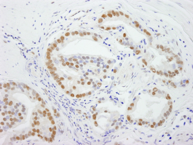 DDX5 Antibody in Immunohistochemistry (Paraffin) (IHC (P))