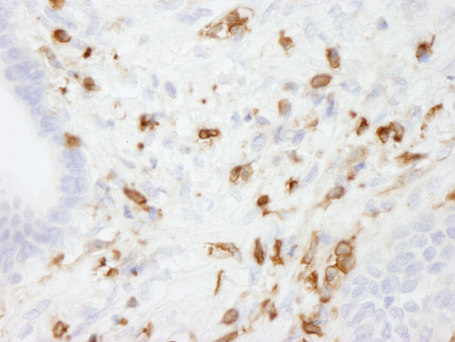 Coronin 1 Antibody in Immunohistochemistry (Paraffin) (IHC (P))