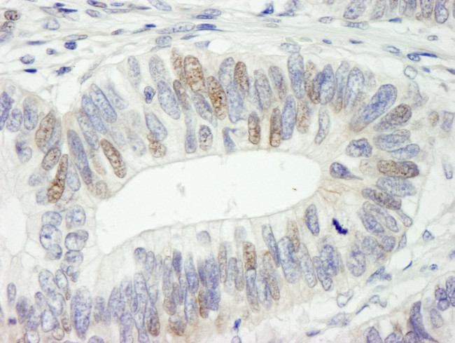 HMG2a Antibody in Immunohistochemistry (Paraffin) (IHC (P))